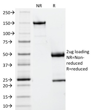 Data from SDS-PAGE analysis of Anti-Beta-2 Microglobulin antibody (Clone B2M/961). Reducing lane (R) shows heavy and light chain fragments. NR lane shows intact antibody with expected MW of approximately 150 kDa. The data are consistent with a high purity, intact mAb.